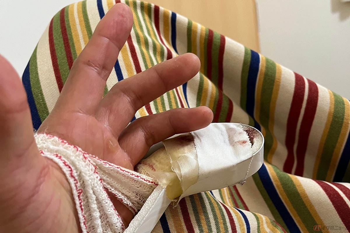 公式テスト3本目で、左小指の第一関節までが削れてしまうなどの大クラッシュを経験